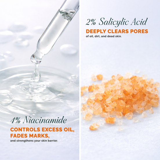 Claymi Acne Fix Serum – With 2% Salicylic Acid, 4% Niacinamide With Azelaic Acid